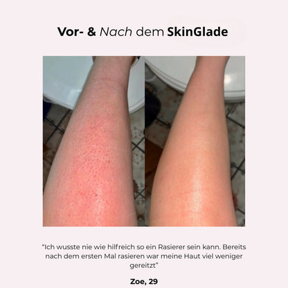 Avora™ | SkinGlide
